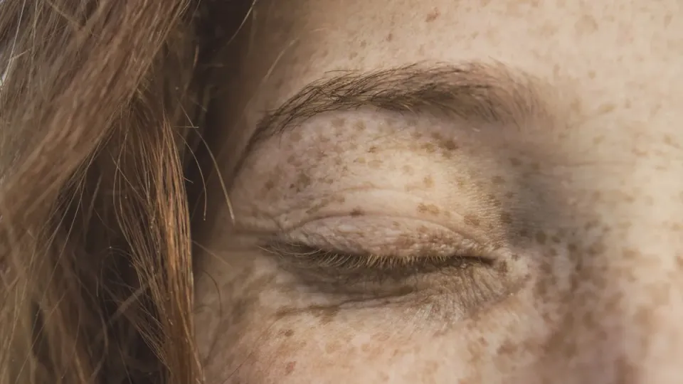 Eucerin Anti-Pigment vs Mela B3: ¿thiamidol o niacinamida?
