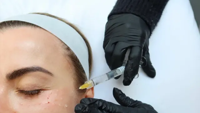 PDRN en skincare: qué es, evidencia real y qué esperar