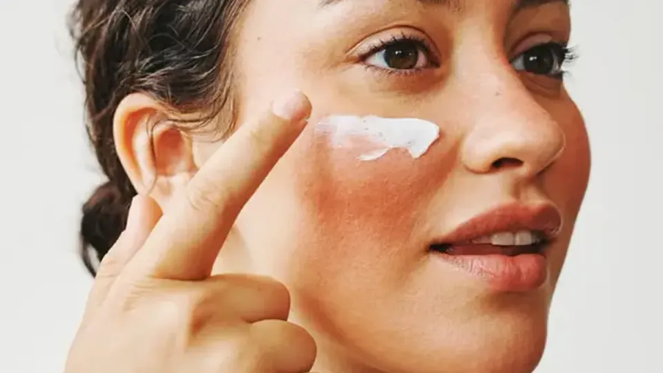 Quemaduras solares: tratamiento, cuidados y prevención